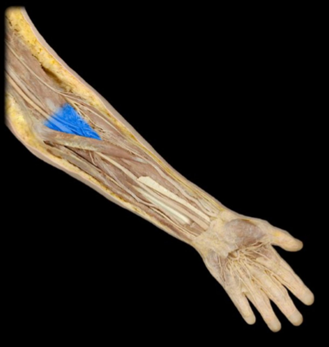 <p>"Sheesh" region of arm</p>