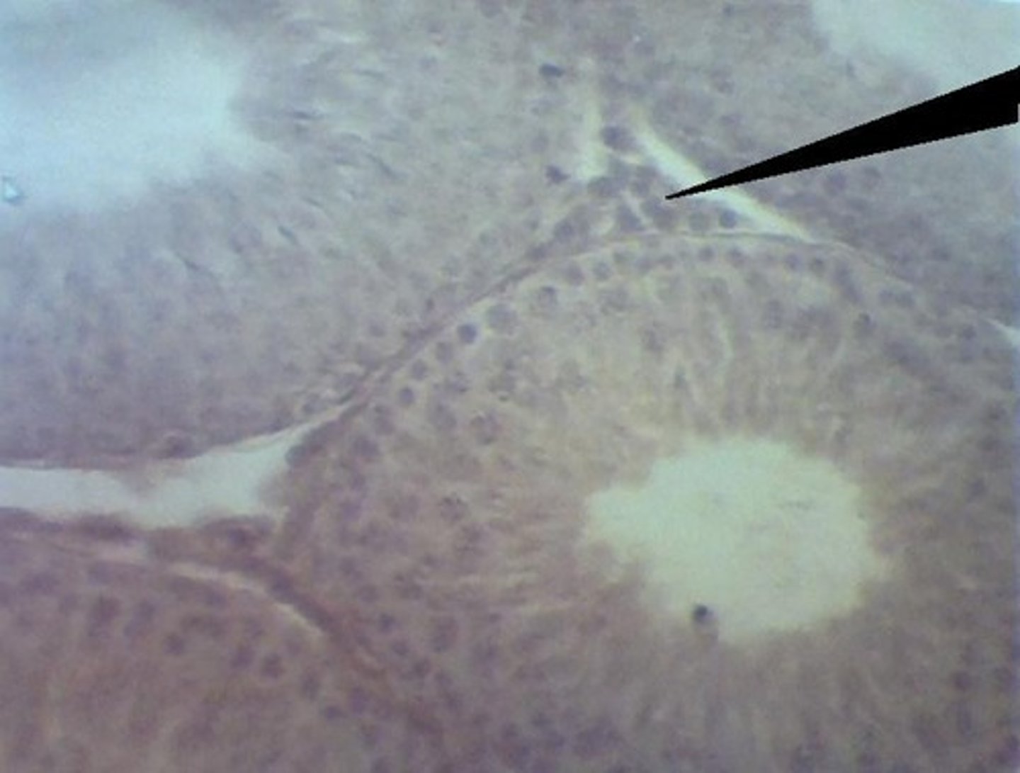 <p>lymph</p>