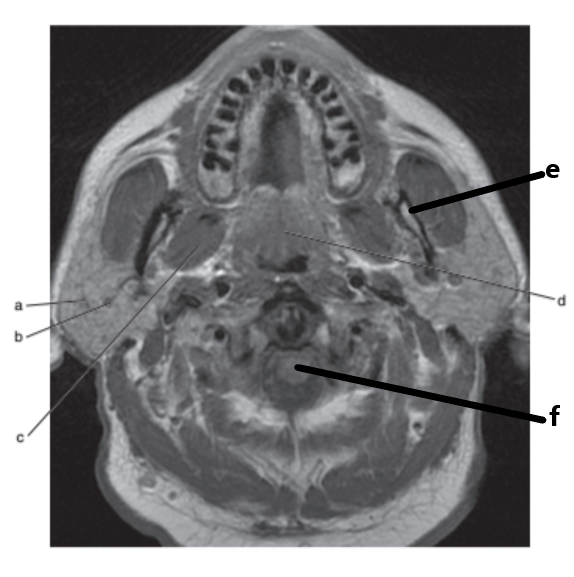 <p>What is letter d ?</p>