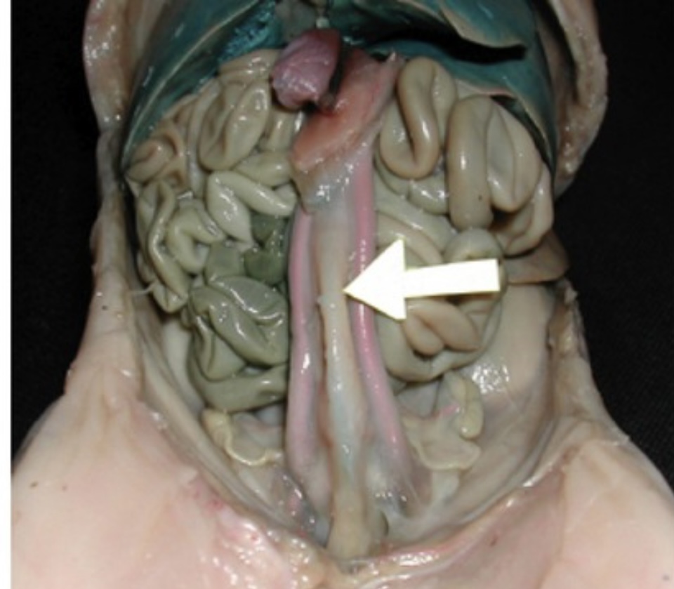 <p>Muscular sac that stores urine before excretion.</p>