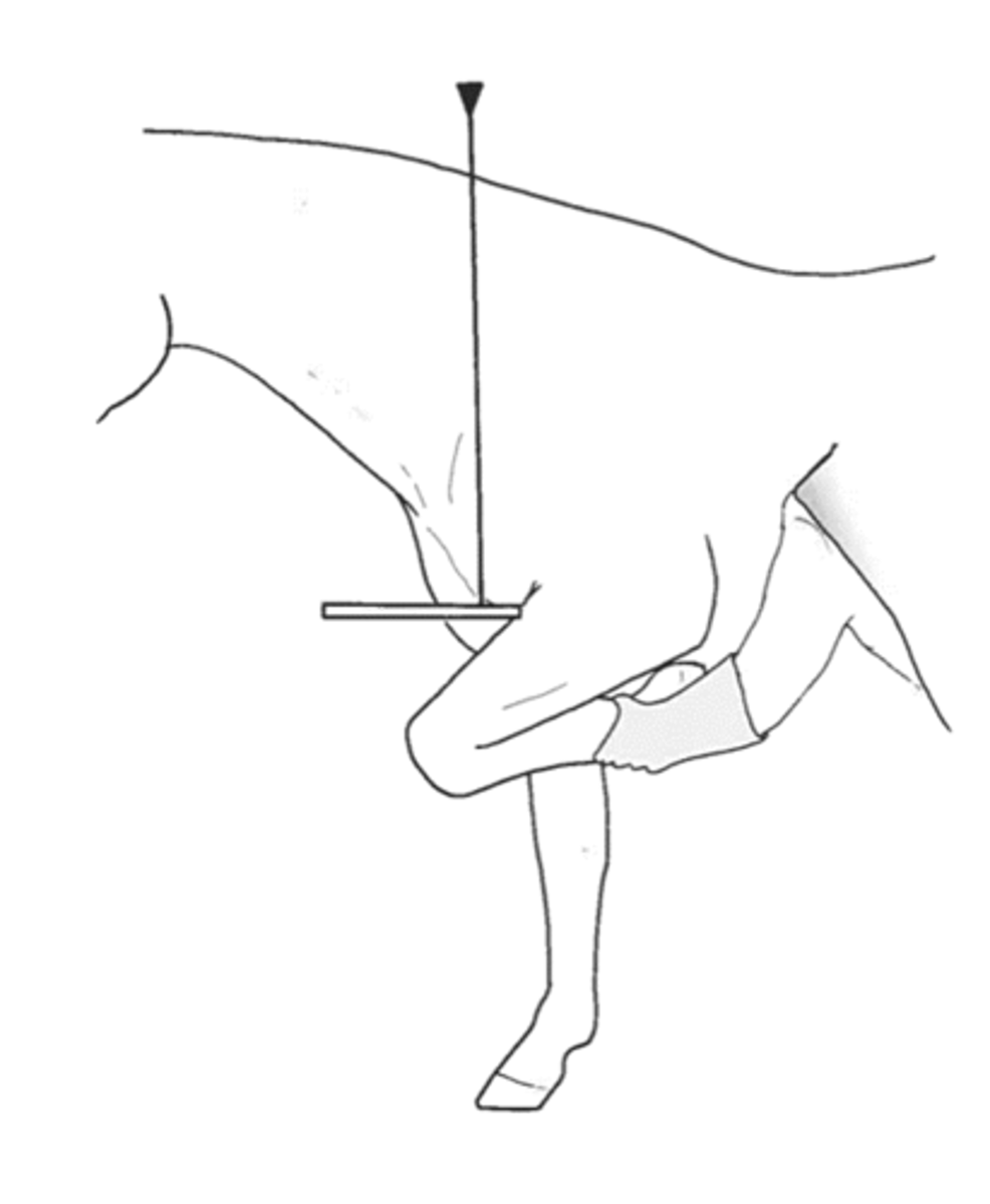 <p>What view of the shoulder joint is taken to highlight the humeral tubercles?</p>