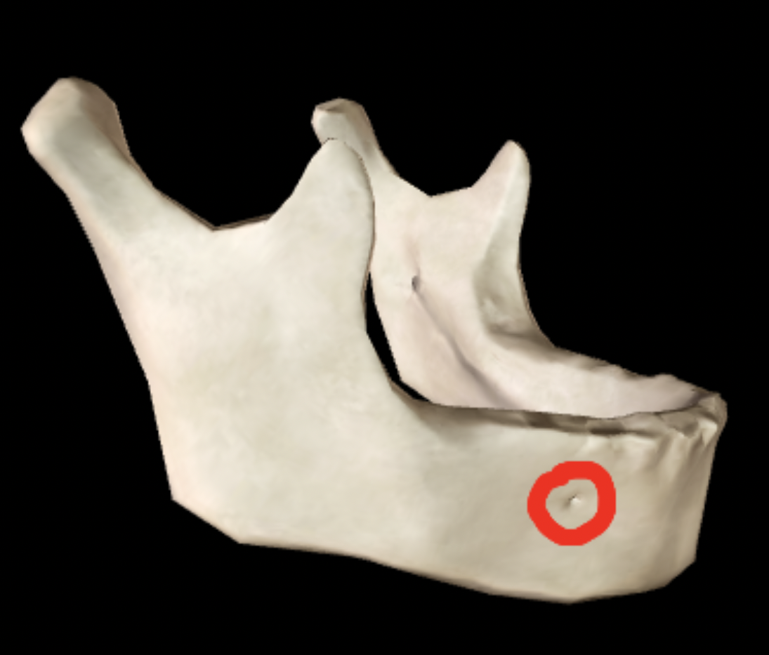 <p>What part of the mandible is this?</p>