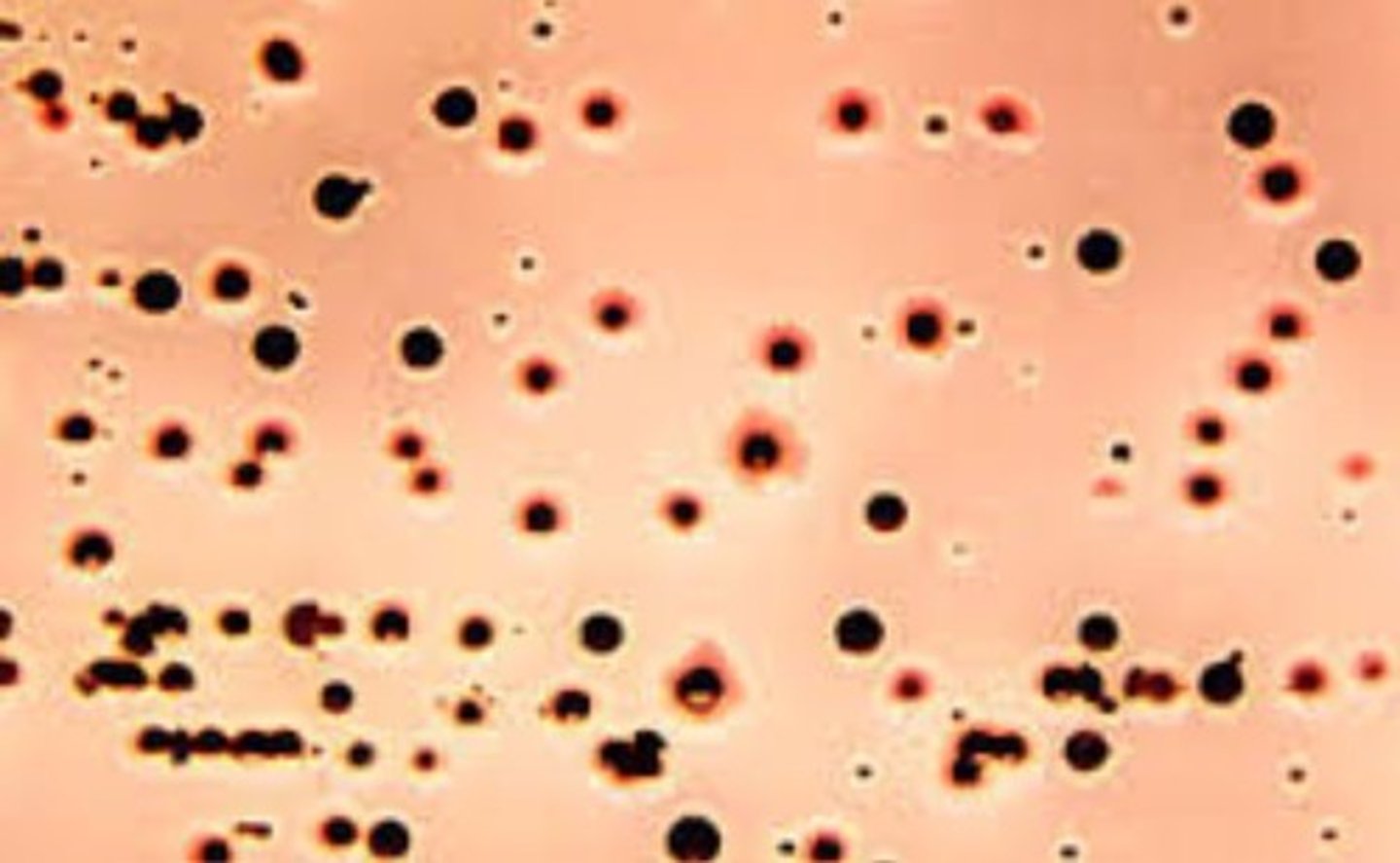 <p>Urea - negative</p><p>Lysine decarboxylase - positive</p><p>Hydrogen Sulfide- positive</p><p>Indole- positive</p><p>Only recognized human pathogen in Edwardsiella genus.</p>