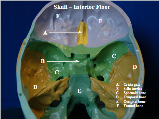 <p>divot in middle of bone inside skull, bottom of bat shape (sphenoid bone landmark) (B on image)</p>