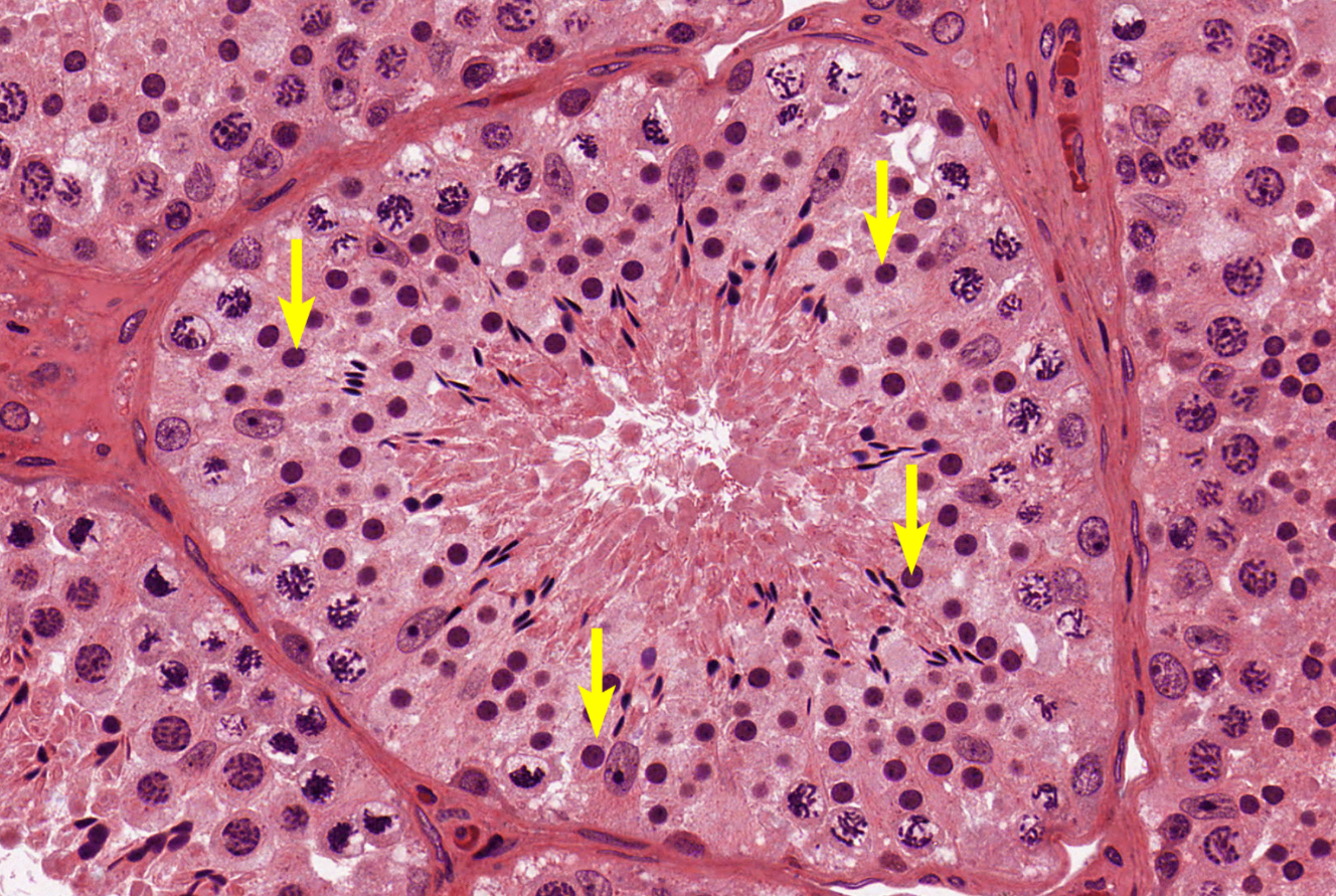 <p>histo specific; small condensed dark nucleus</p>