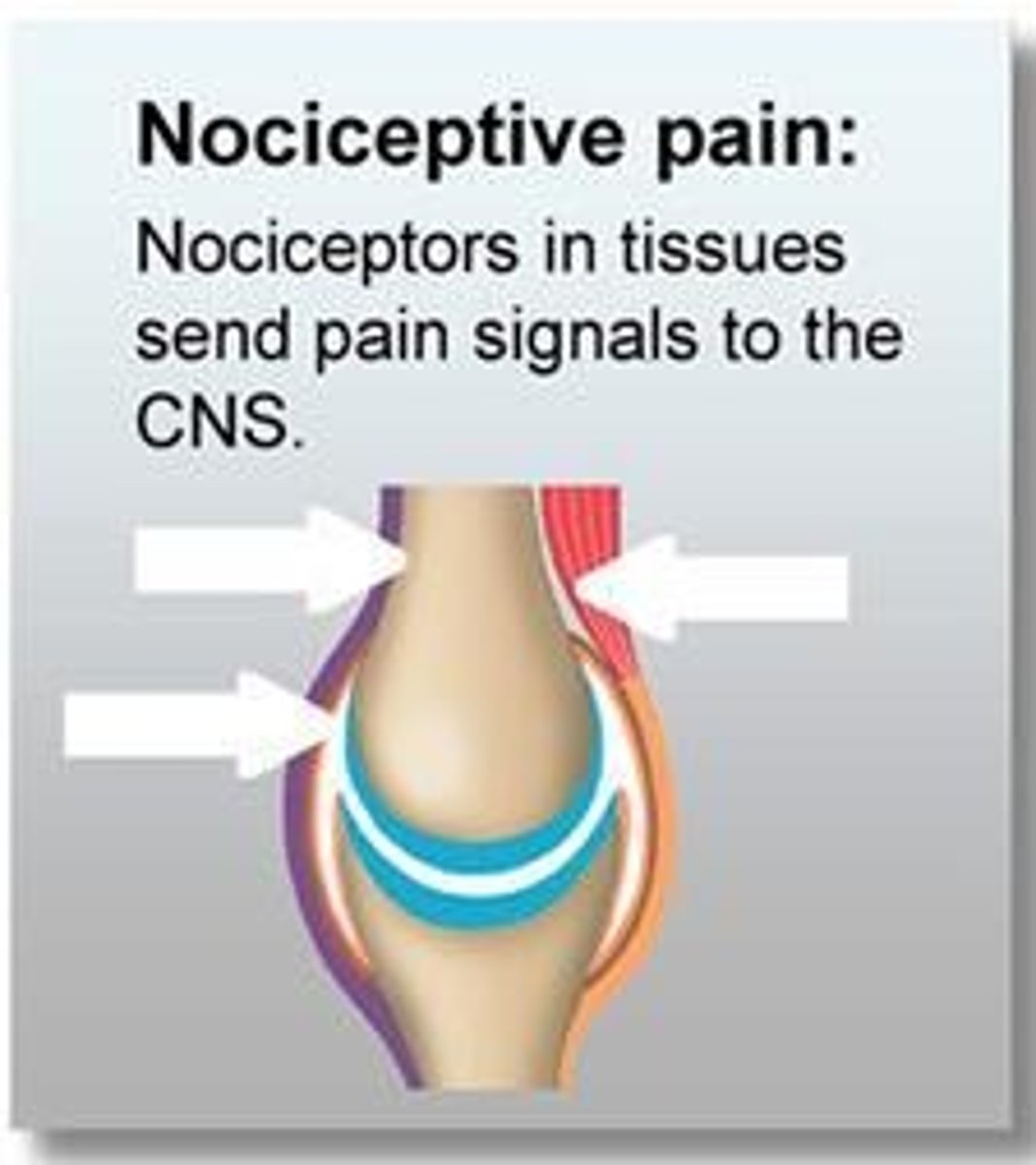 <p>Noxious stimuli act on intact nociceptors to increase signaling, leading to pain perception.</p>