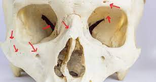<p>round oval opening through the bone</p>