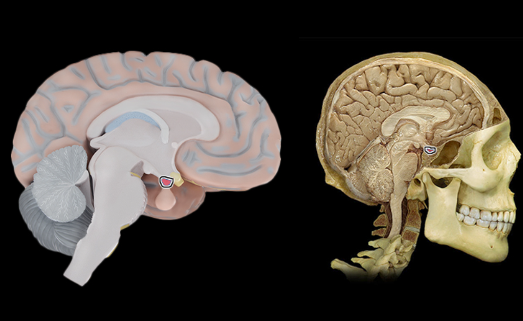 term image