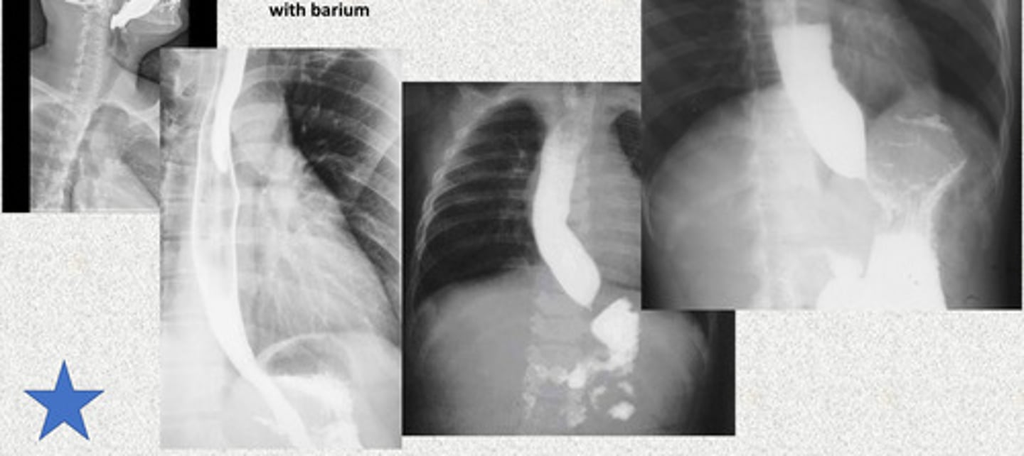 <p>Achalasia/stricture</p>
