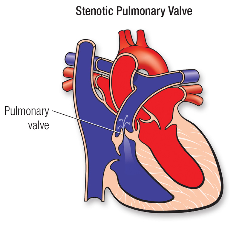<p><span>one of the four valves that regulate blood flow in the heart; lies between the lower right ventricle and the pulmonary artery</span></p>