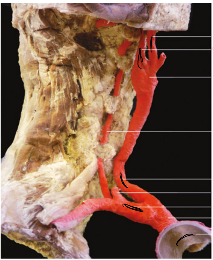 <p>Isvardink kraujagysles</p>