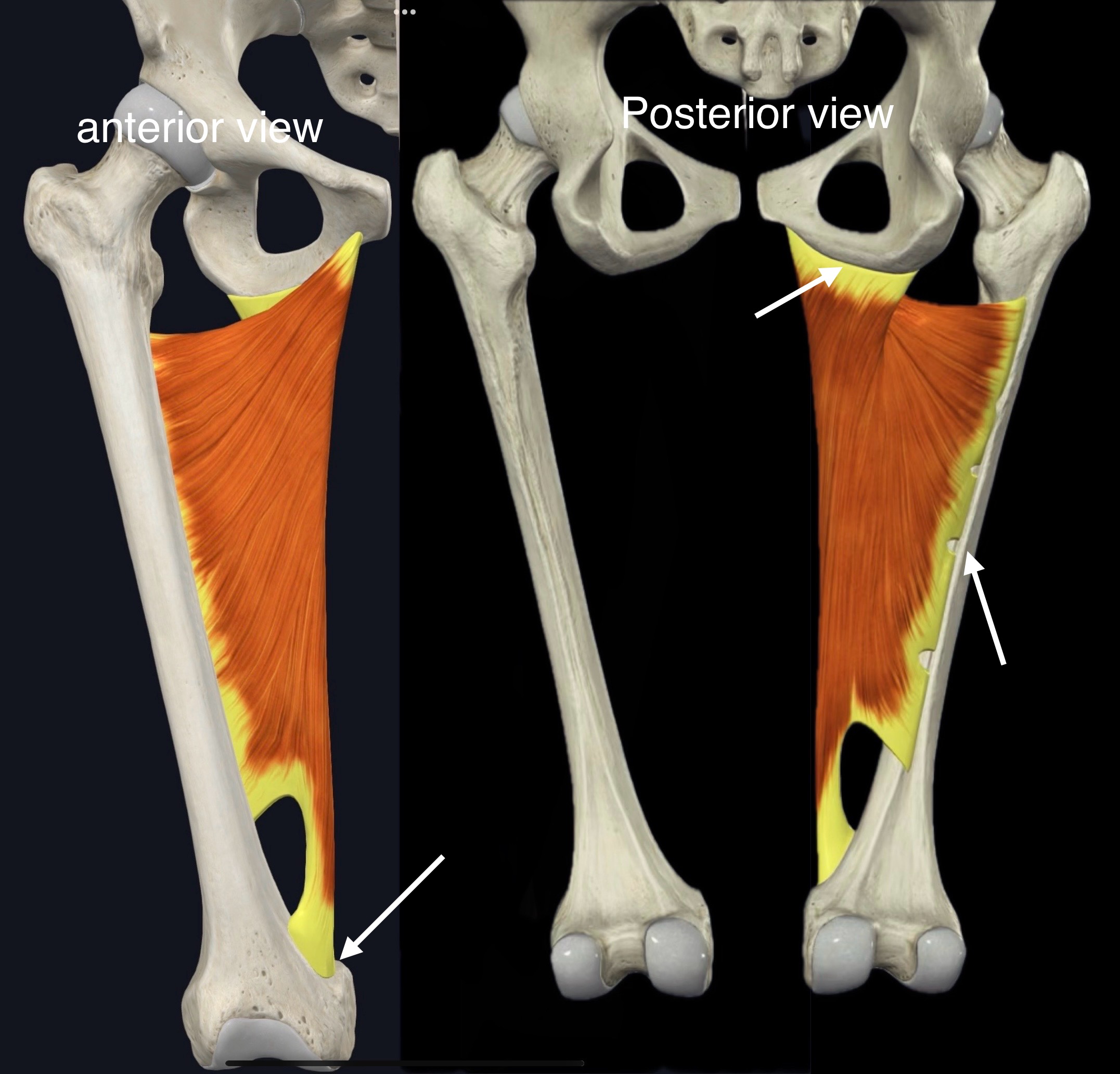 <p>Name the muscle, origin and insertion</p>