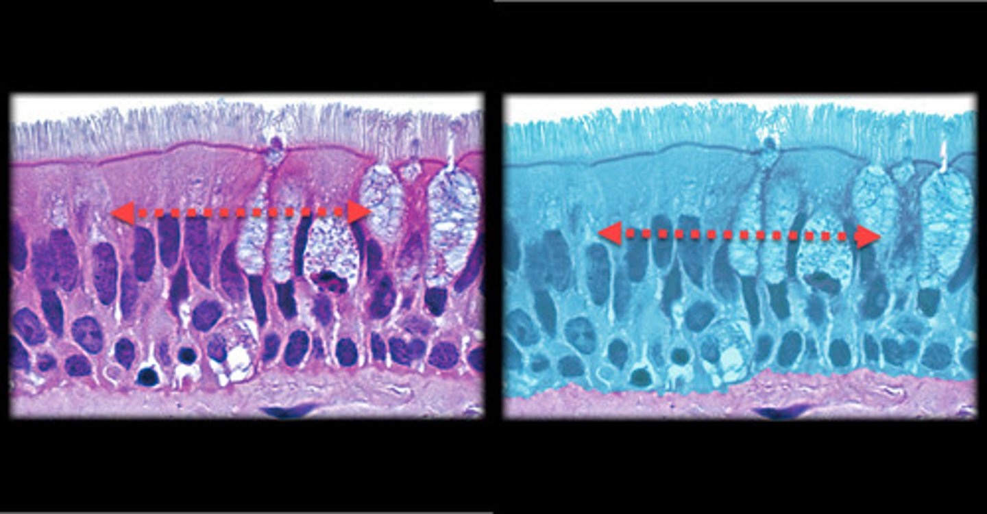 <p>- Appears layered due to nuclei at different heights, it is actually a single layer.</p><p>- All cells contact the basement membrane.</p><p>- Cilia are present on the surface.</p><p>- Found in the trachea and upper respiratory tract, where the cilia help move mucus.</p>