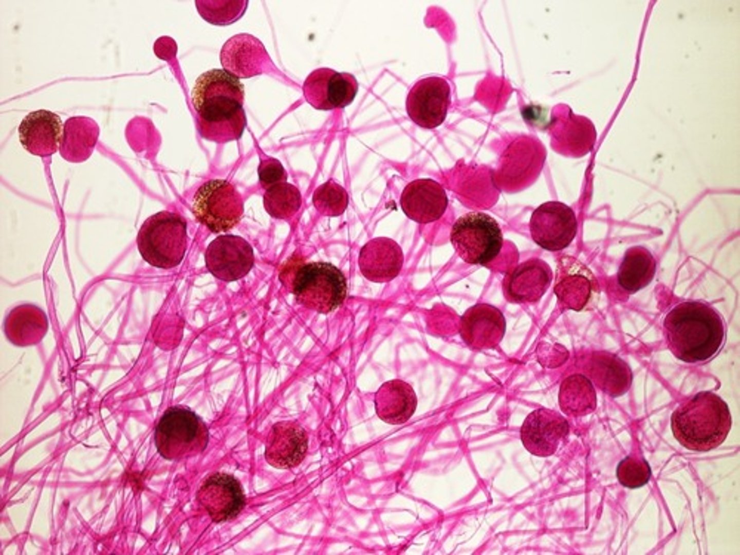 <p>organs at tips of sporangiophores that release spores</p>