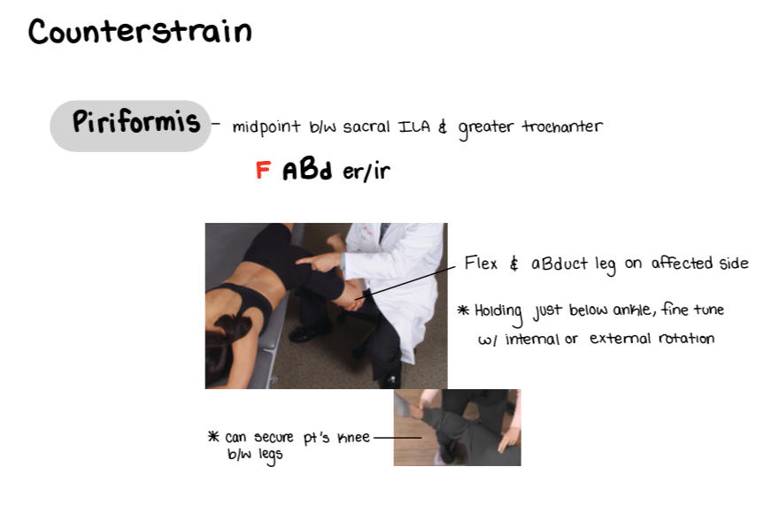 <p>Point is between sacral ILA and greater trochanter</p><ol><li><p>Stand on same side</p></li><li><p>Ask pt to move to edge of table</p></li><li><p>Move leg down and hold between your knees</p></li><li><p>Flex and ABduct leg on affected side</p></li><li><p>Hold just below ankle and fine tune with internal or external rotation</p></li></ol><p></p>