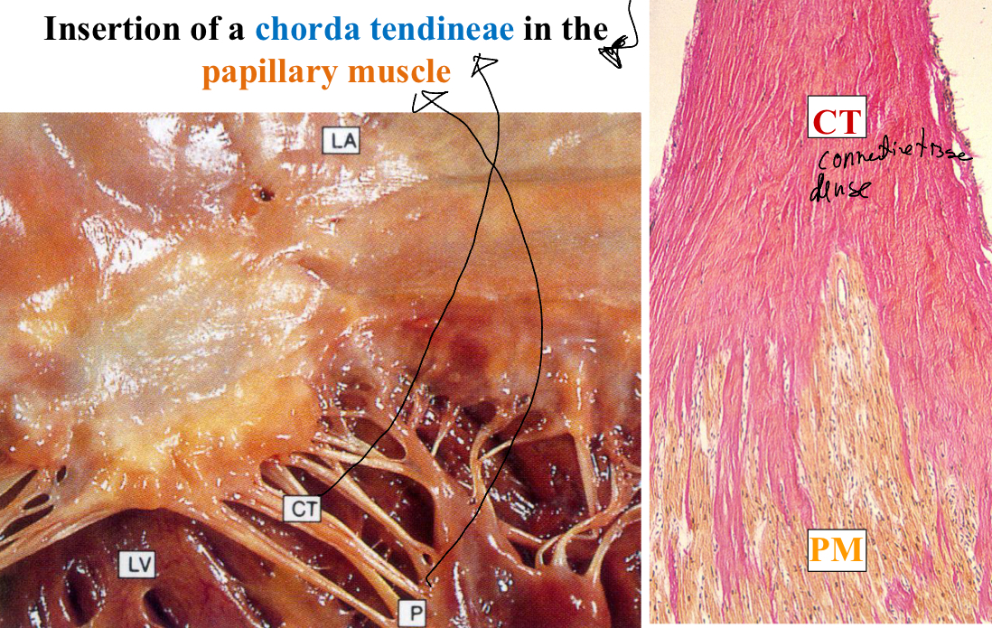 <p>Explain the atrioventricular valves histologically</p>