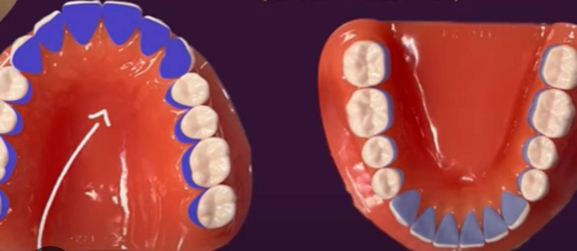 <p>The maxillary arch (top teeth) and the mandibular arch (bottom teeth).</p>