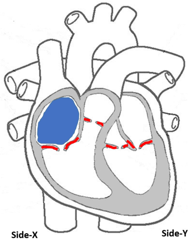 <p>What&apos;s the name of the labeled chambers</p>