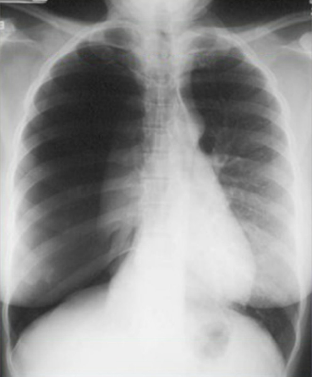 <p>What pathology is this?</p>