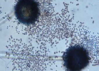<p>conidia jet black &amp; granular</p><p>vesicles are obscured by dense conidia</p><p>BISERIATE, cover entire vesicle</p>