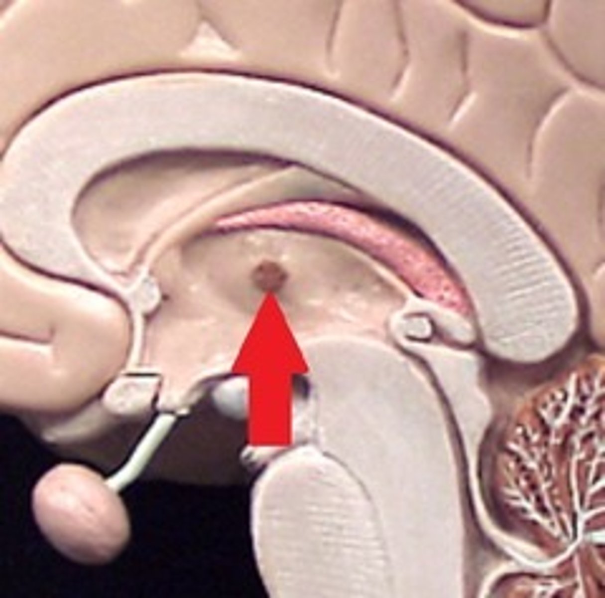 <p>connects parts of the thalamus</p>