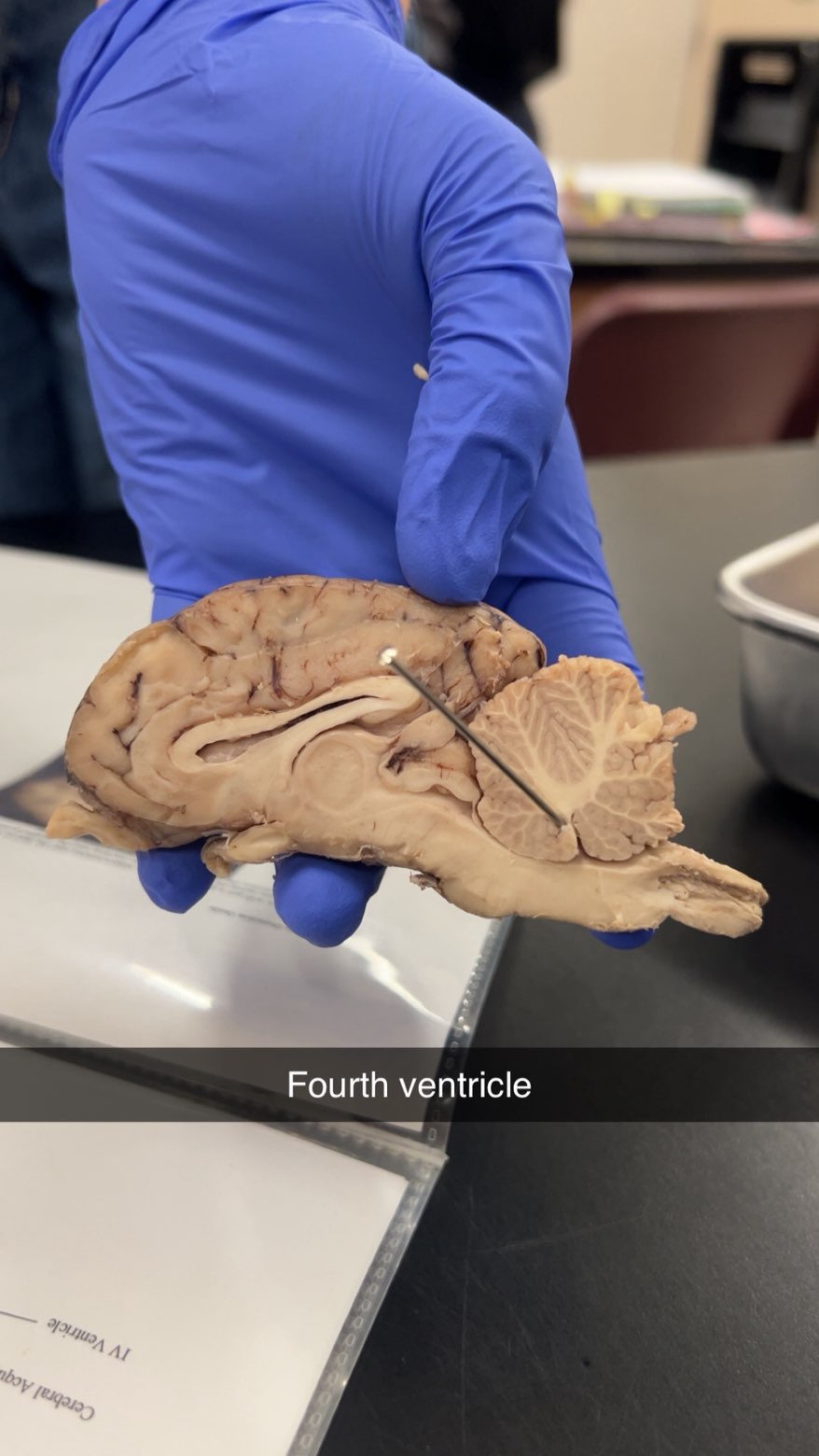 <p>4th ventricle</p>