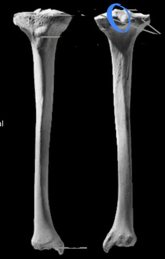 <p>Located on the tibia, attachment for ligament structure (e.g., ACL, MCL, meniscus)</p>