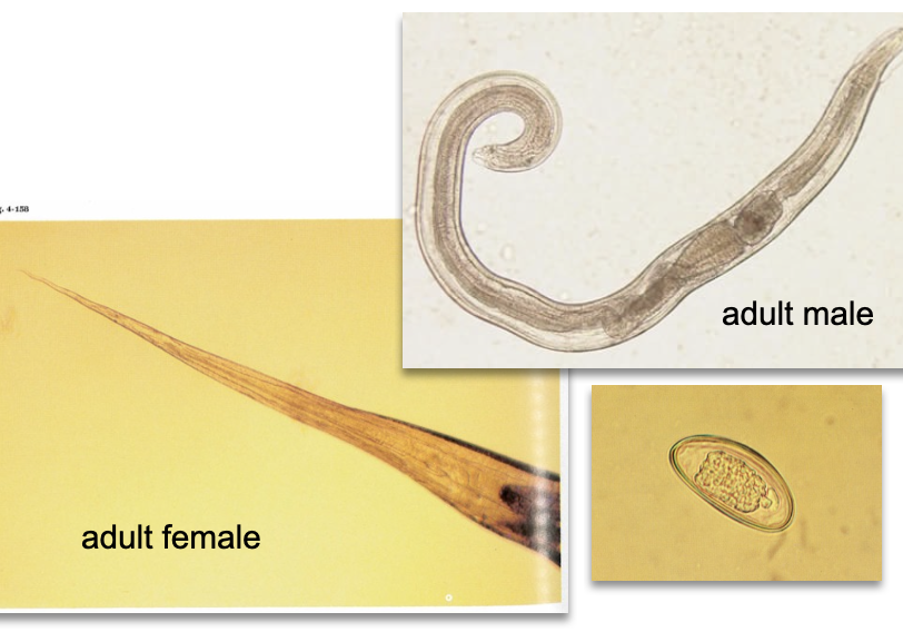 <ul><li><p class="">Intestinal nematode</p></li><li><p class="">Eggs or worms enter urine via fecal contamination</p></li><li><p class="">Most common in children</p></li><li><p class="">Oval, flattened eggs with a thick shell</p></li></ul><p class=""><em>Contextual Note: Not a true urinary parasite—presence indicates contamination or fistula.</em></p><p class=""></p>