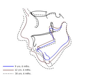 <p>Björk’s findings pt. 2 </p>
