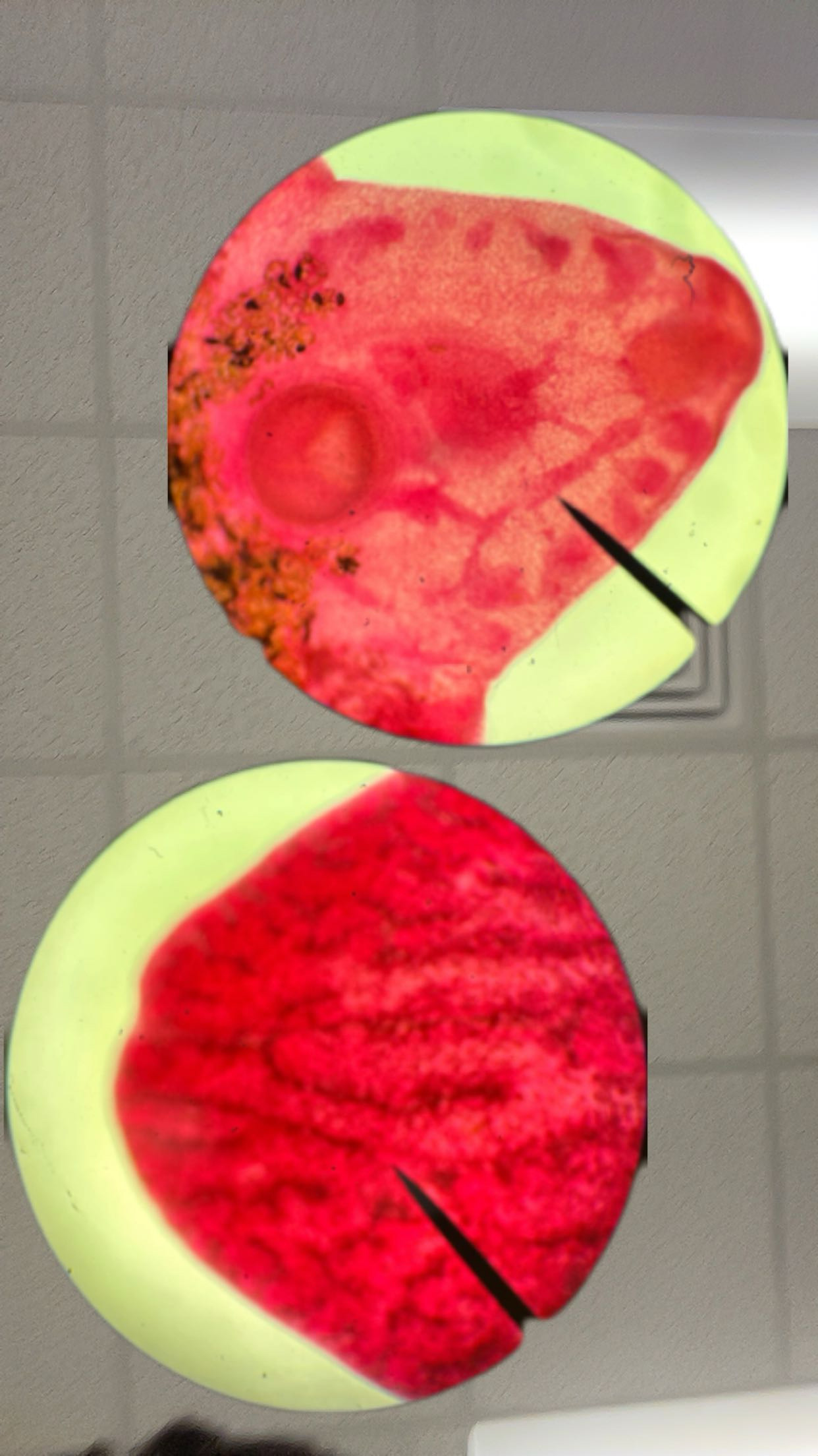 <p>Identify the organism and the Class it belongs to</p>