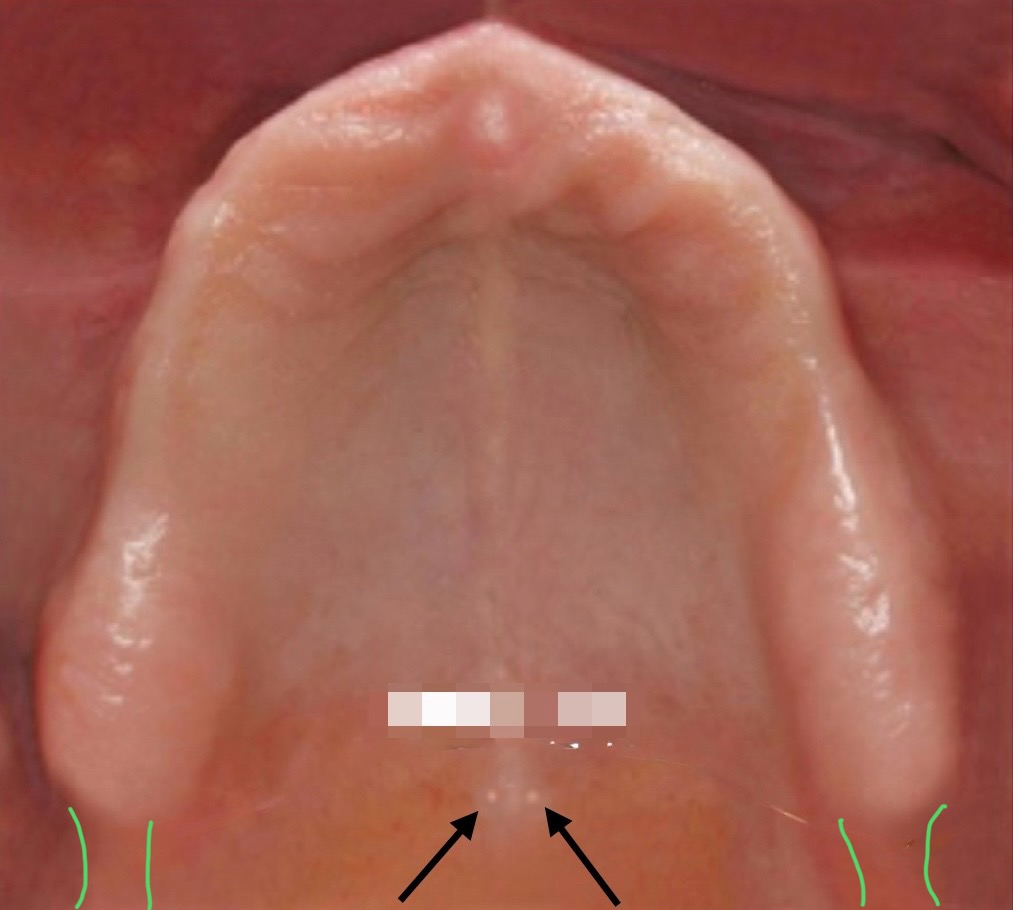 <p>what structure are the black arrows pointing to?</p>