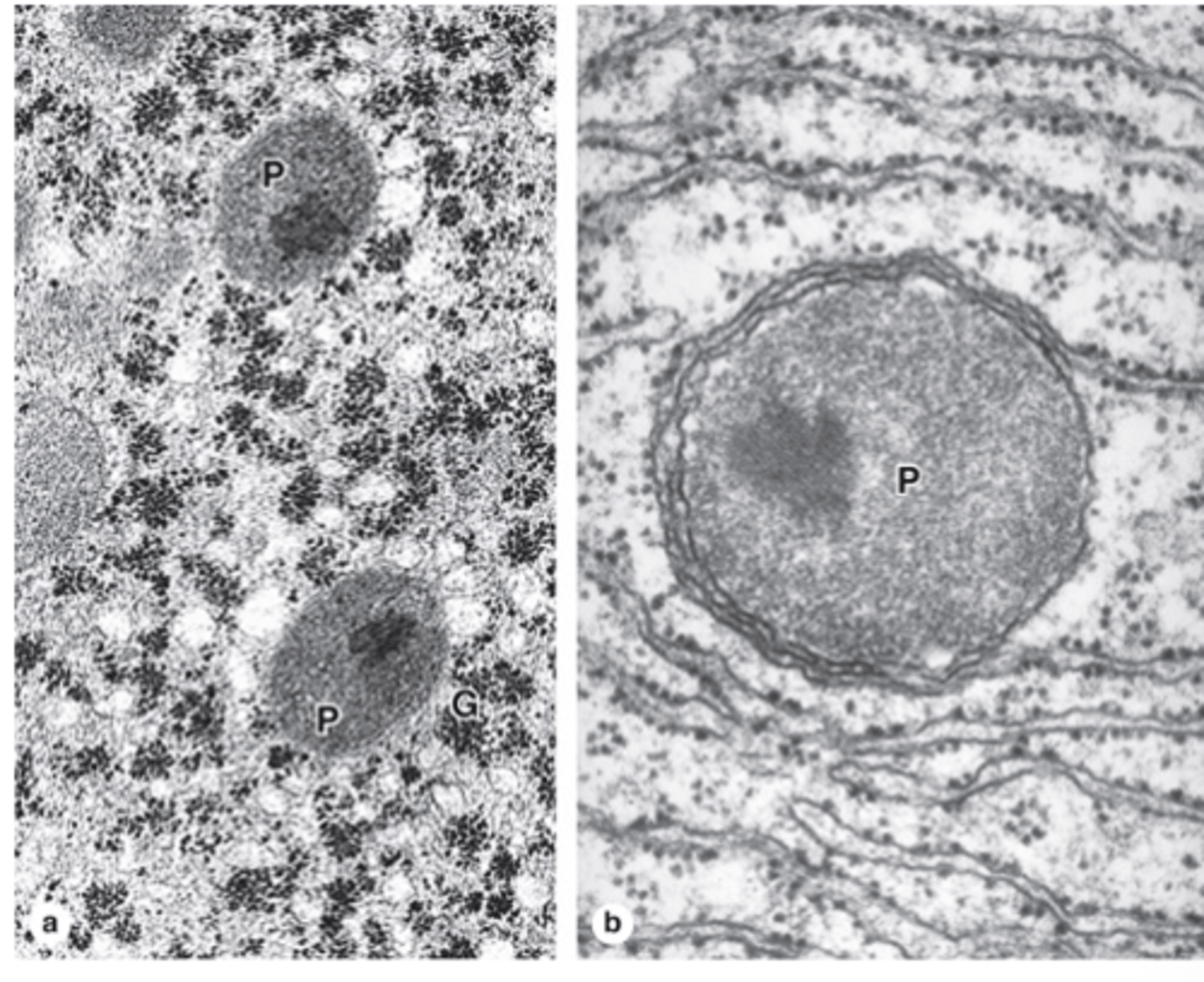 <p>What are the main functions of peroxisomes? (2)</p>