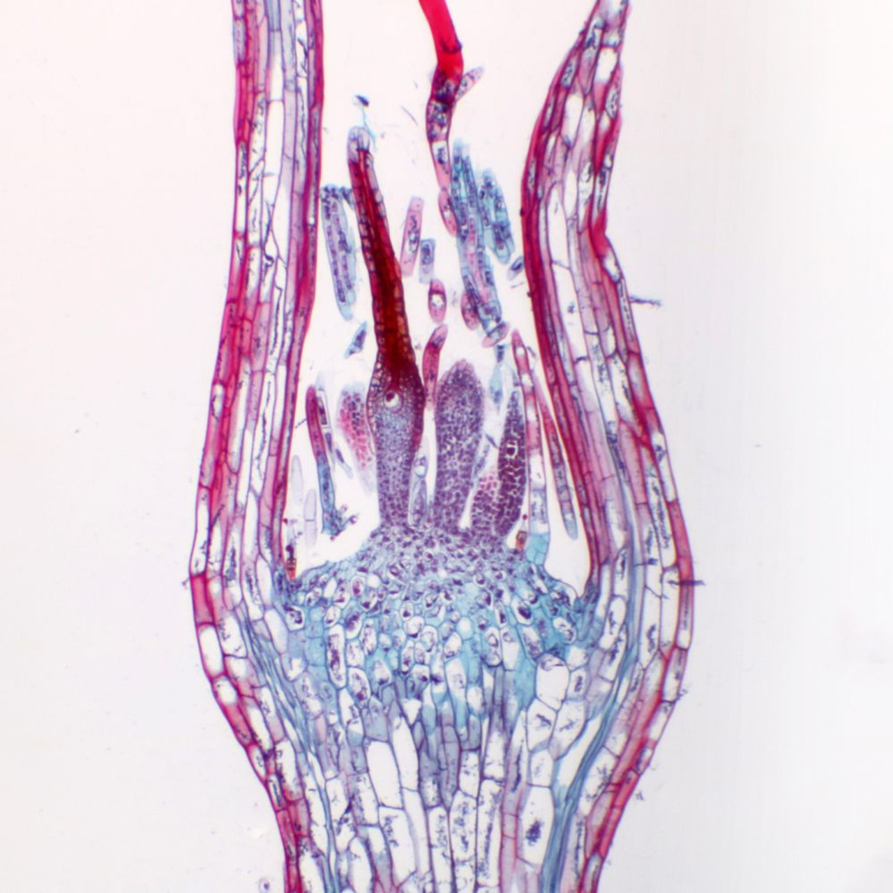 <p>Which division does this Archegonial Head belong to?</p>