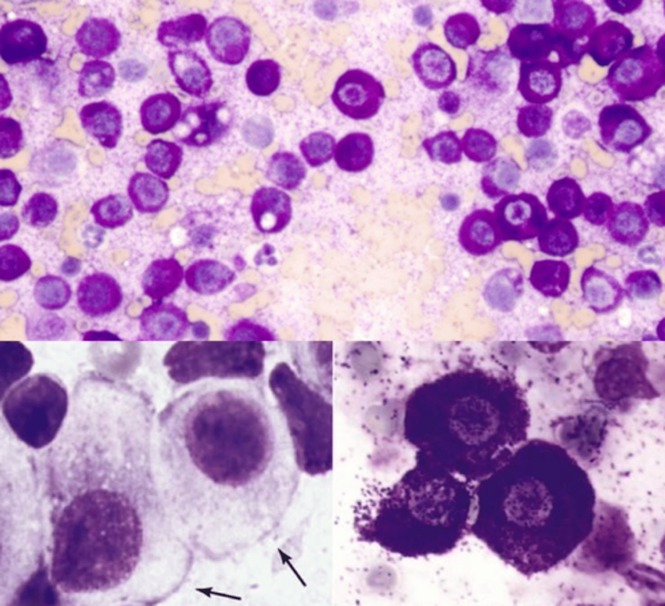 <p>Identify the type of round cell neoplasia?</p>