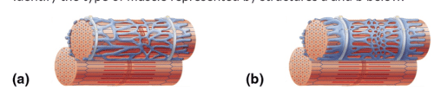 <p>Label muscle/muscle fiber type B</p>