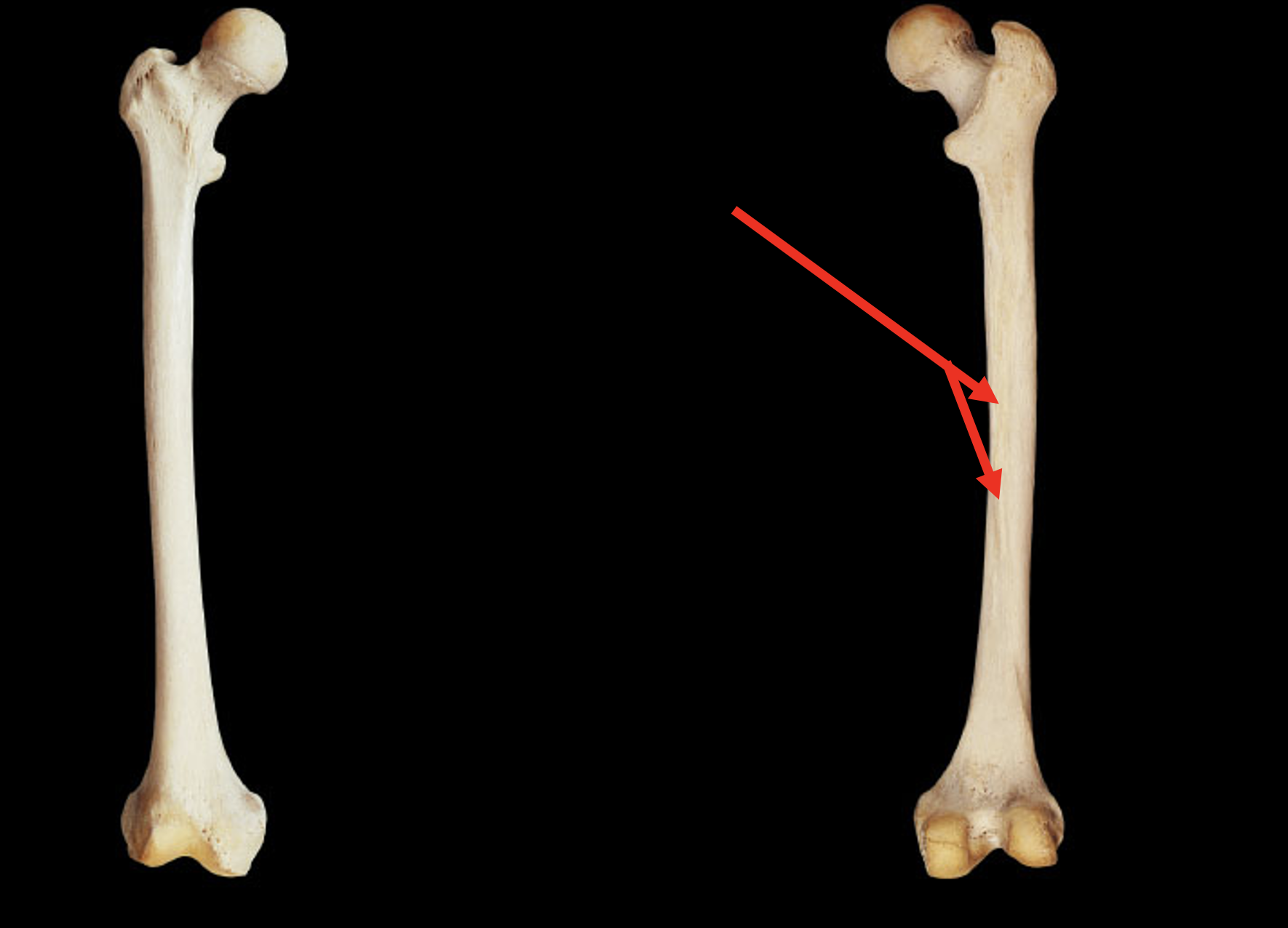 <p>Name this region of the femur</p>