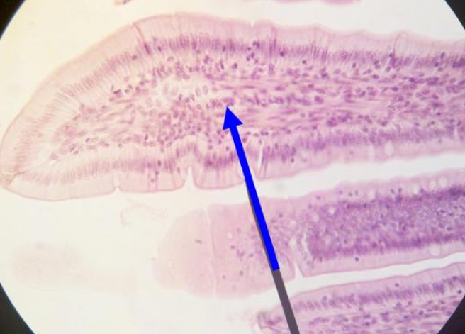 <p>What is the arrow pointing to?</p>