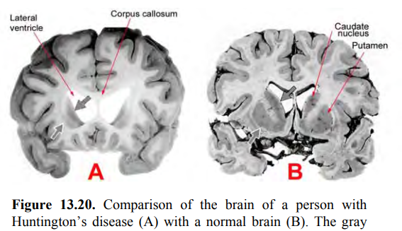 <p>Why is there no thalamus shown in Figure 13.20? __________________________________________ Does this figure appear to be stained with a cell or fiber stain? ______</p>