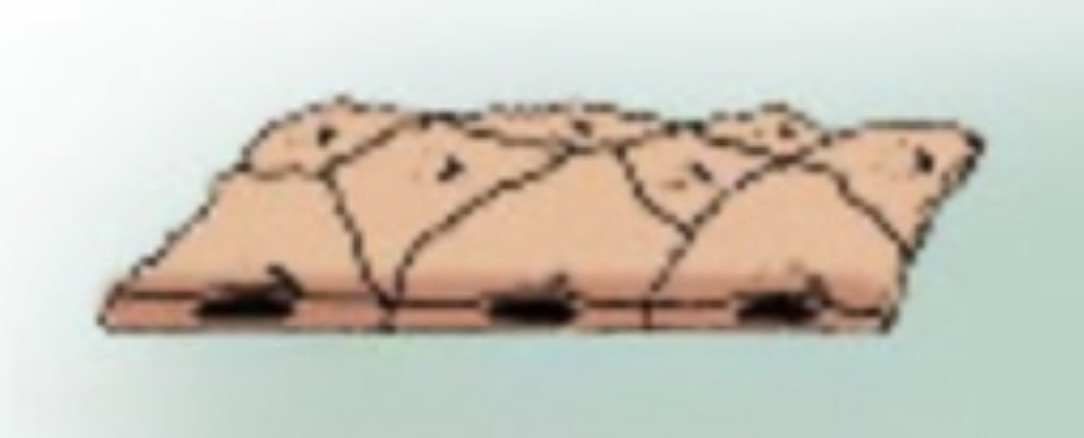 <p>What type of Epithelium is this?</p>