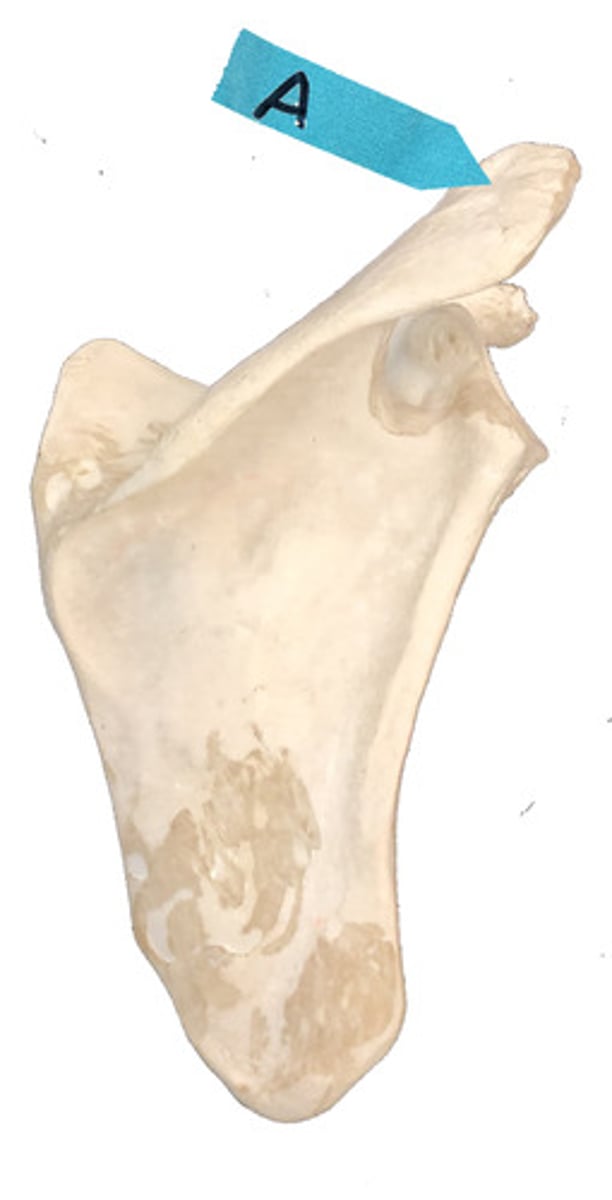 <p>Identify this bone marking.</p>