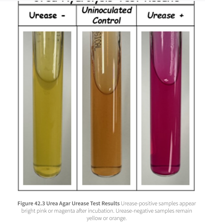 <p>urea agar image</p>