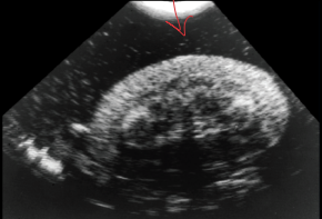 <p><span style="background-color: transparent;"><strong>Ethylene Glycol</strong></span></p>