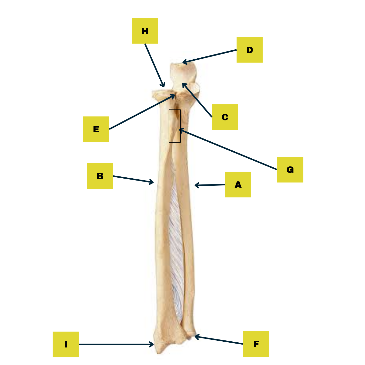 <p>Label A: What is this bone called?</p>