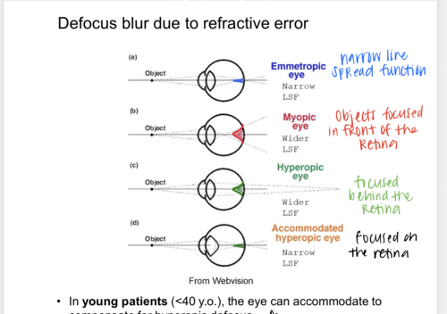 <p>True or False: </p><p>In young patients, the eye can accommodate to compensate for hyperopic defocus</p>
