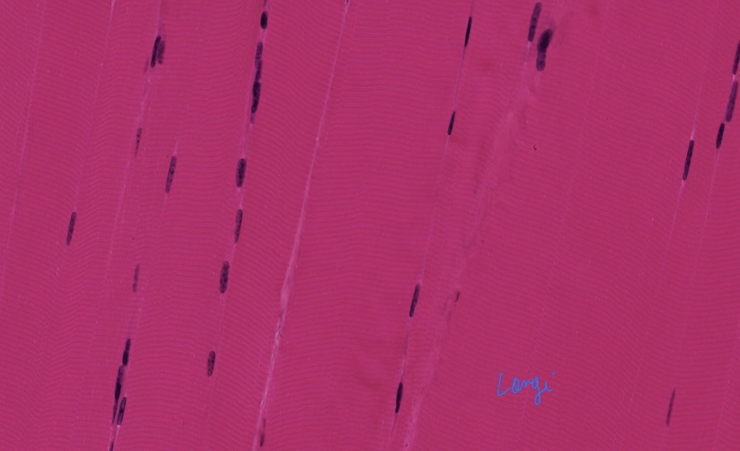 <p>Tejido muscular esquelético</p>