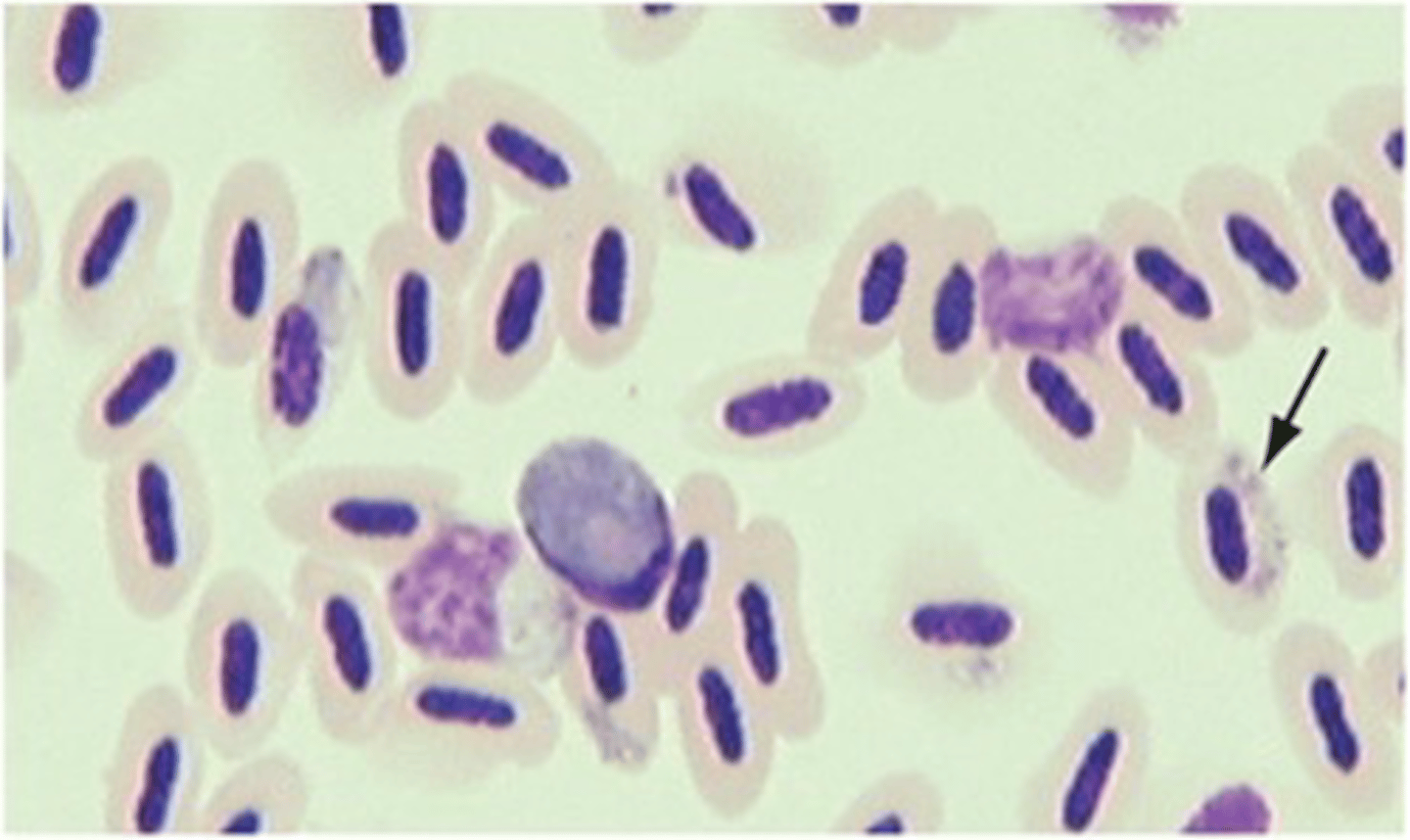 <p>The trophozoite form that looks like a "sausage-shaped body" is produced by the protozoan:</p>