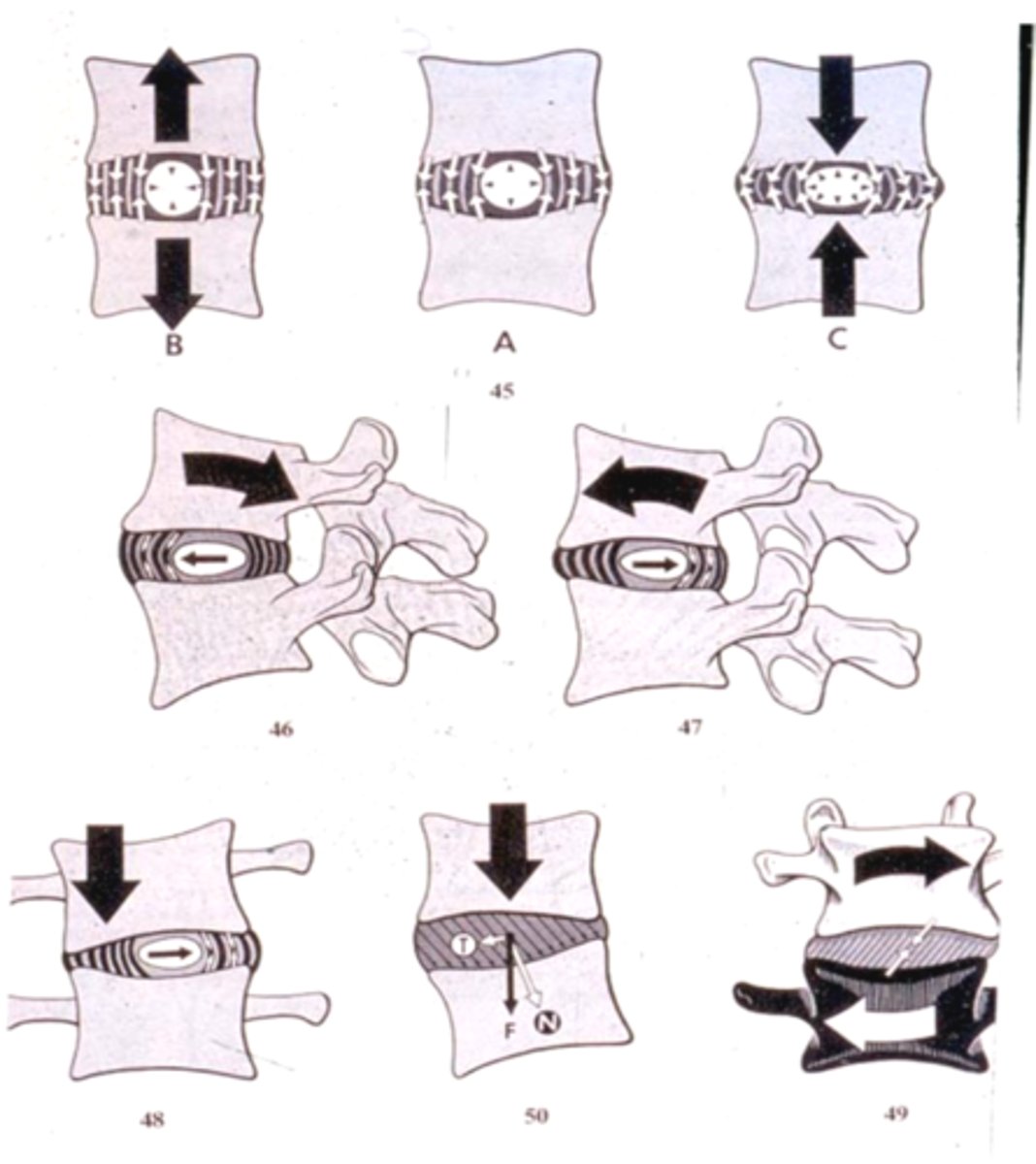 <p>AF = tension is Anterior </p><p>NP = pushed Anterior </p><p>flexion = opposite </p>