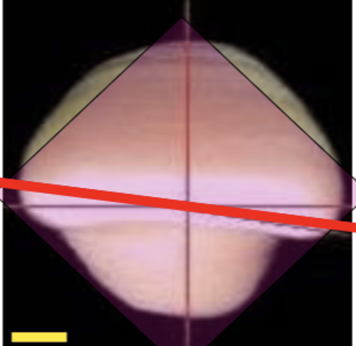 <p>- incisal ridge of lateral incisors is more distally angled to allow dental arch curvature</p><p>(gets in contact with canines where this starts)</p>