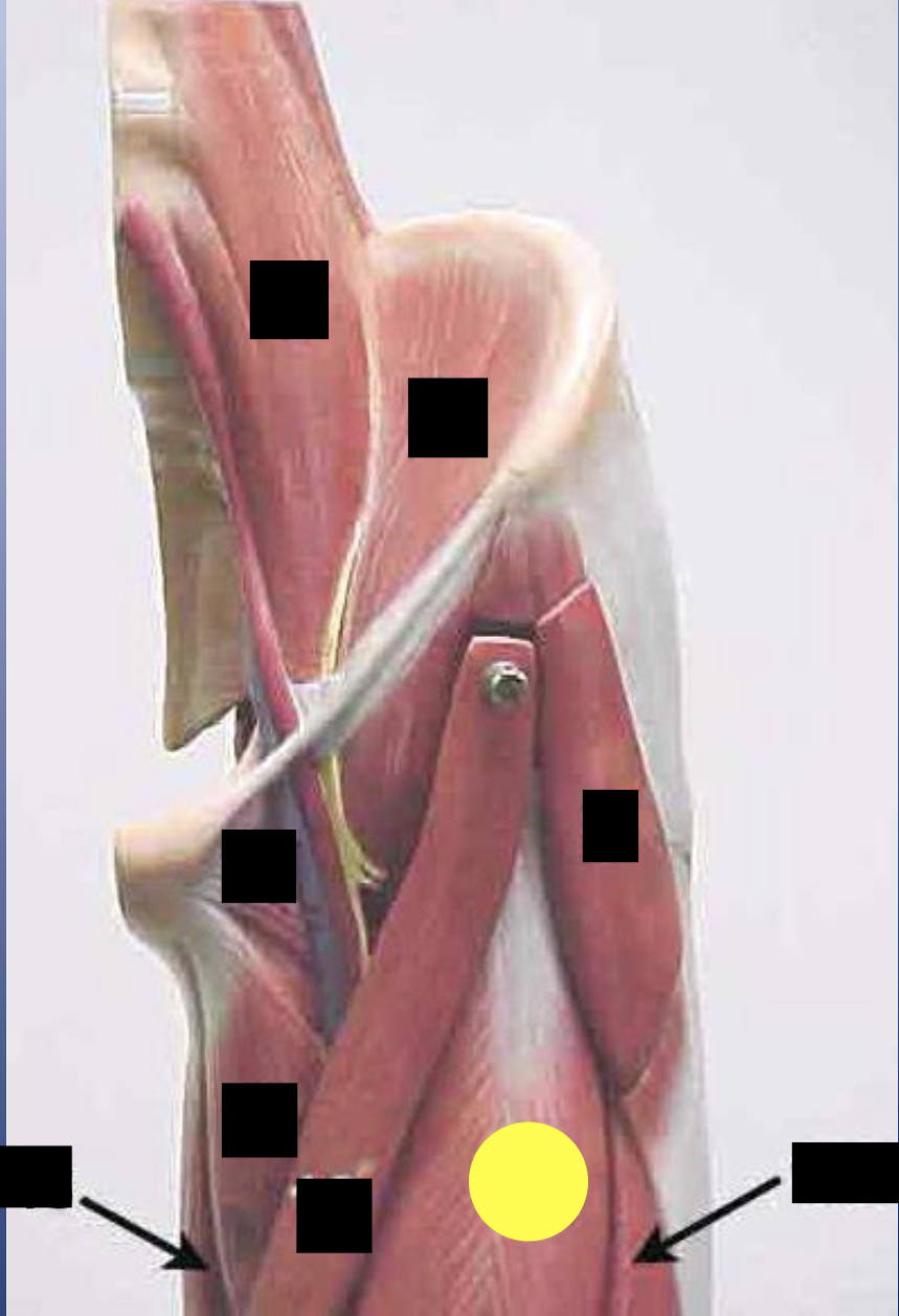<p>What muscle is this? (<strong>11A</strong>) *****</p>