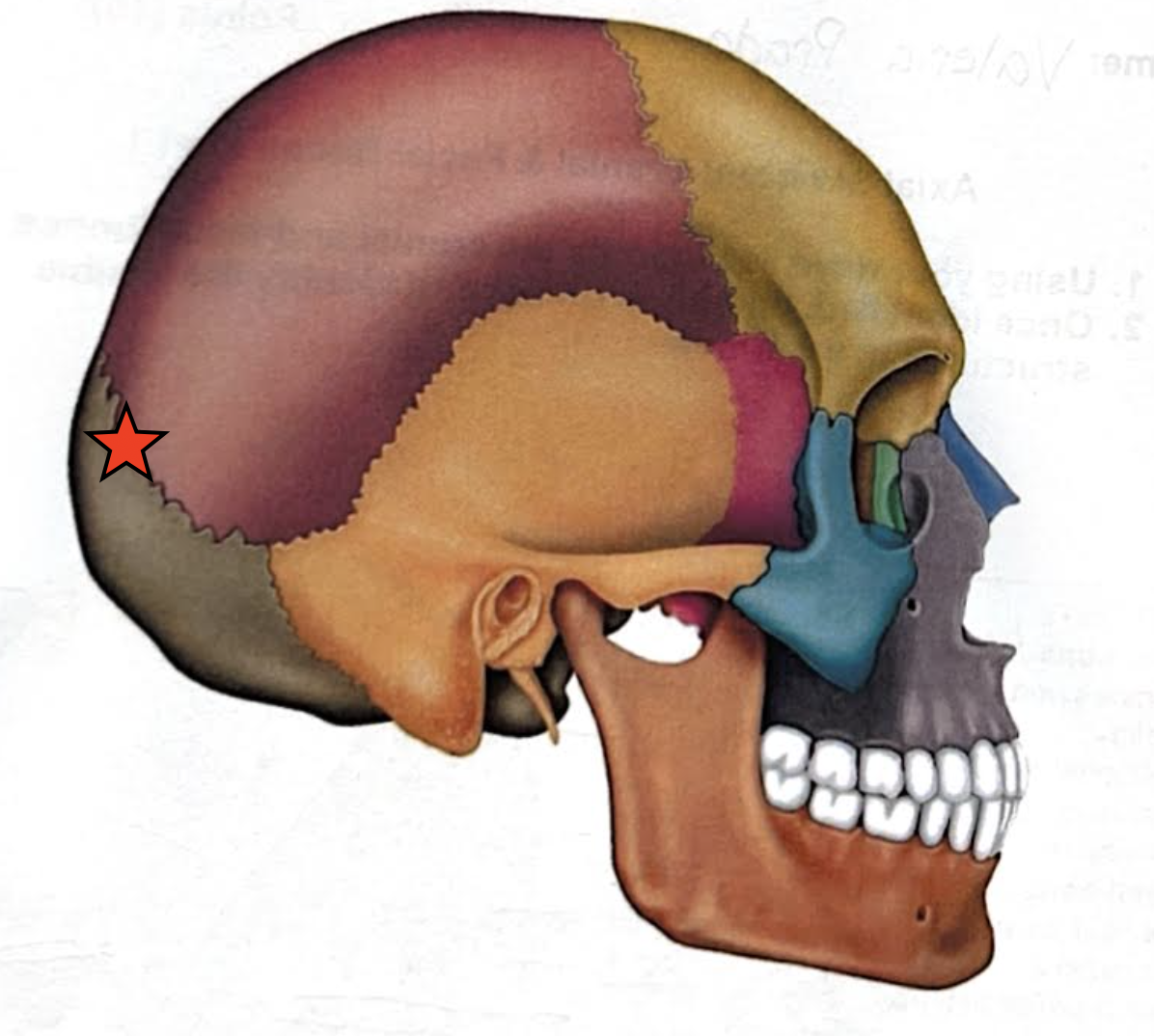 term image